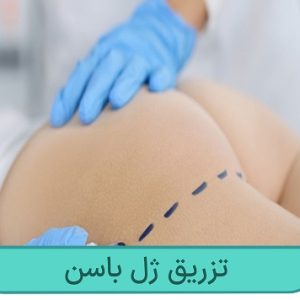 تزریق ژل به باسن